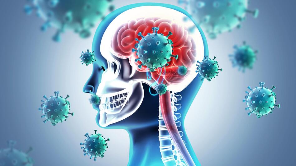 Long Covid, Gedächtnisstörungen, Neuroinflammation, Corona-Spätfolgen, Hirnnebel