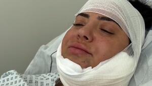 Leyla Heiter kann nach Beauty-OP nicht richtig reden