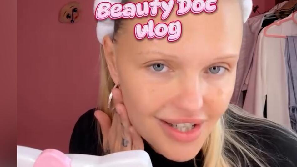 Vlog beim Beauty-Doc: Fans feiern Bonnie Strange für ihren ehrlichen Einblick