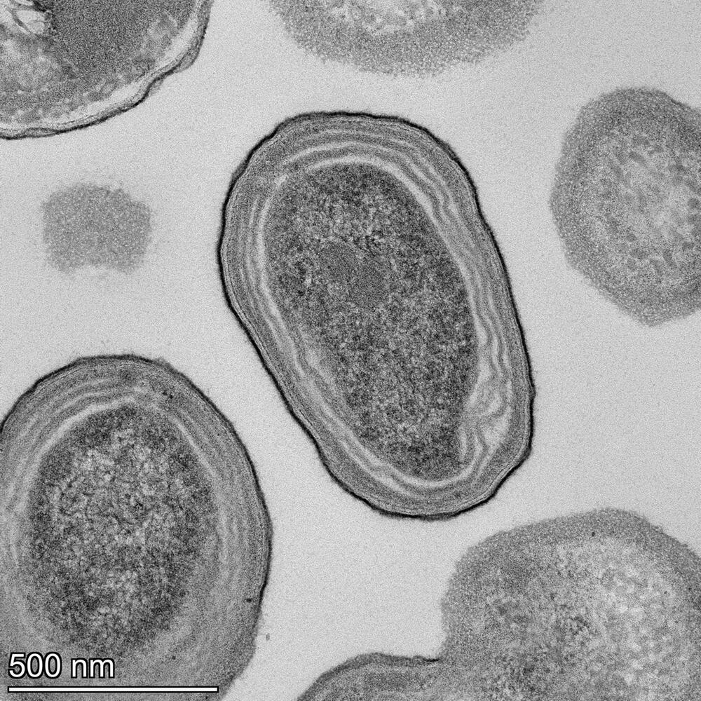 Prochlorococcus-Zellen