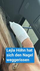 Lejla Höhn reisst sich Fingernagel ab