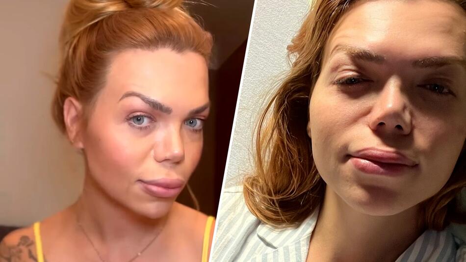 Schockdiagnose mit 36: Influencerin Nicolette Fountaris erleidet Schlaganfall