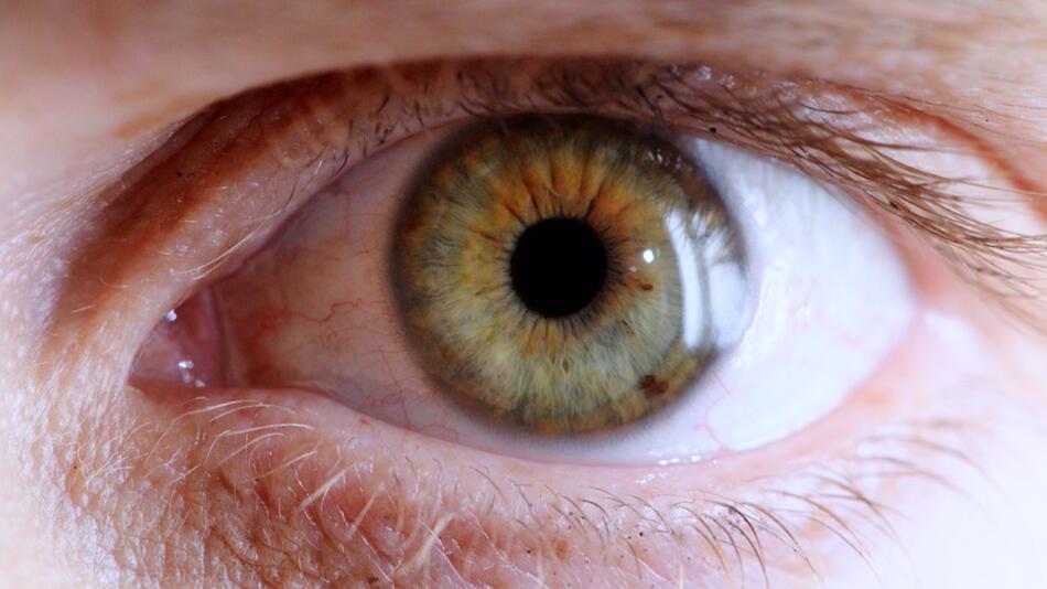 Braun, Blau oder Grün: Was Ihre Augenfarbe über Ihre Gesundheit verrät