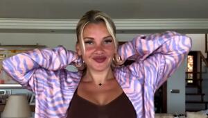Reality-Star Evelyn Burdecki: So bekämpft sie ihren Haarverlust