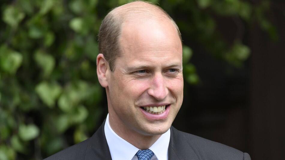 Prinz William hat an der Schläfe eine kleine Narbe, die aus seiner Kindheit stammt.