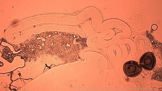 Regelmässiges Ejakulieren steigert männliche Fruchtbarkeit
