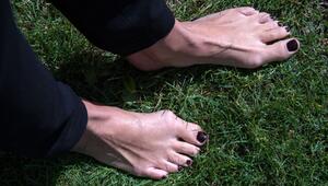 Füsse einer Frau mit Zehenfehlstellung Hallux valgus
