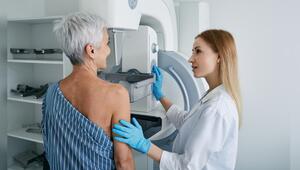 Die Mammografie zählt zu den wichtigsten Vorsorgeuntersuchungen bei Frauen ab 50.