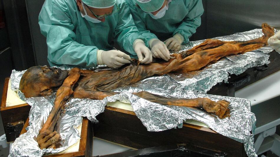 Ötzi