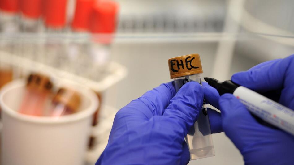 Ehec-Bakterien
