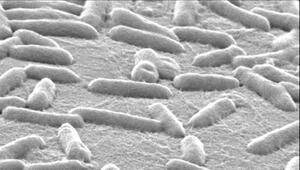 Pseudomonas-aeruginosa-Bakterien