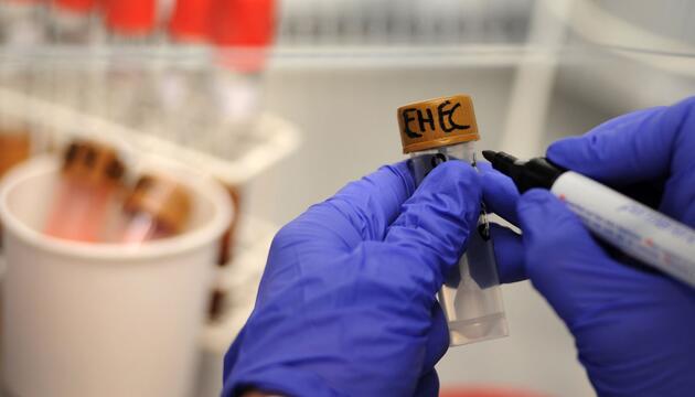Ehec-Bakterien