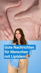Durchbruch für Lipödem-Patientinnen